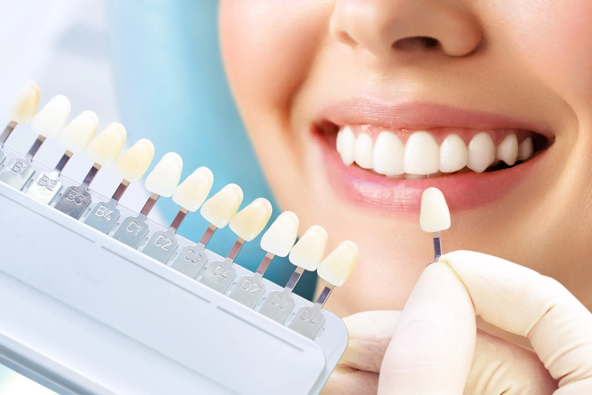 Cosmetological teeth whitening in a dental clinic. selection of the tone of the implant tooth