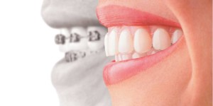 ottawa downtown dentist orthodontics