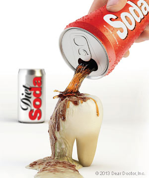 bad teeth from soda