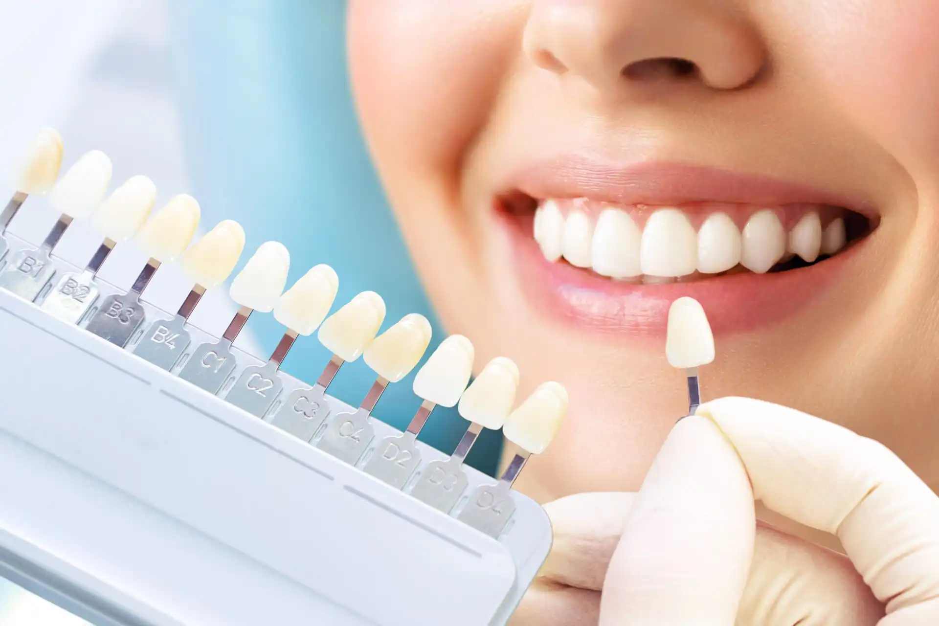 Cosmetological teeth whitening in a dental clinic. selection of the tone of the implant tooth