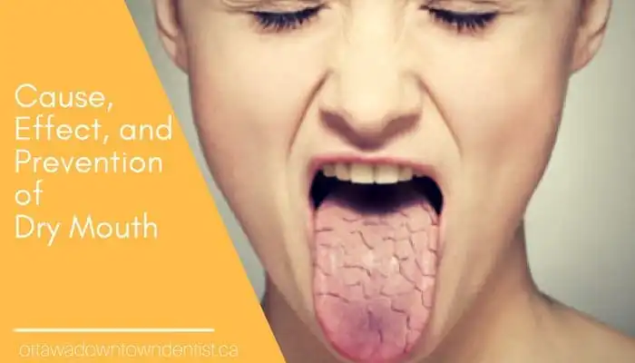 Image of woman with Dry Mouth